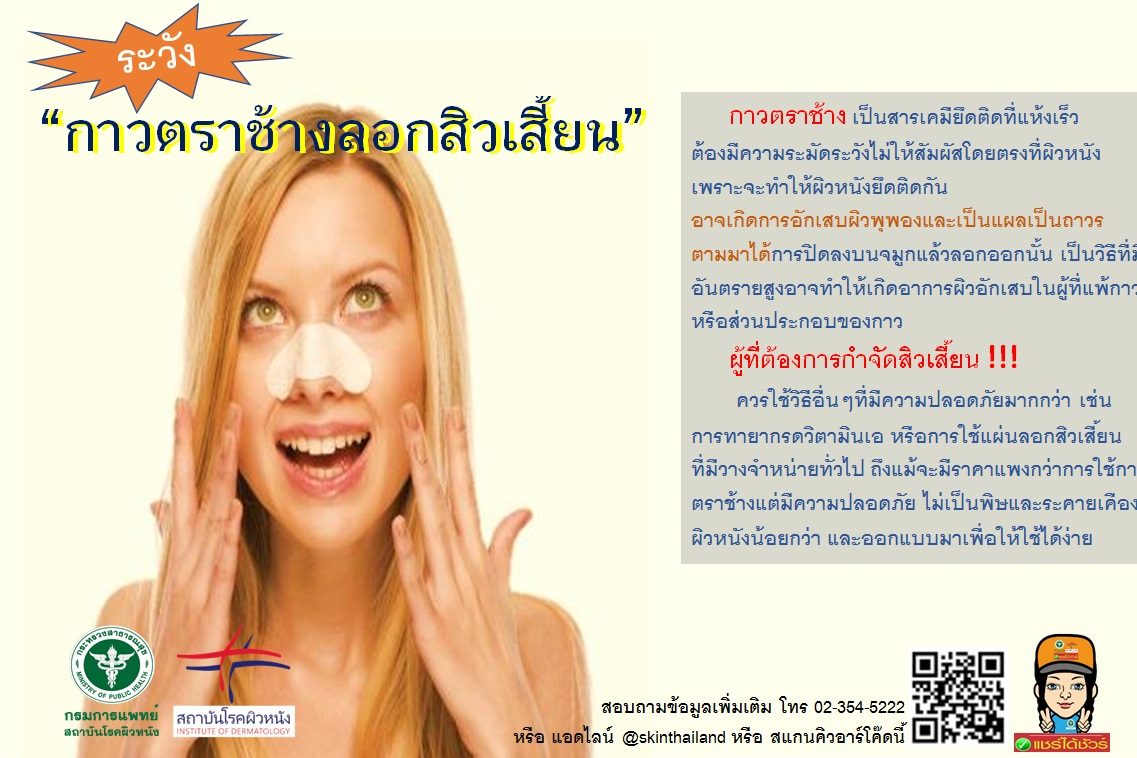 สิ้วเสี้ยน