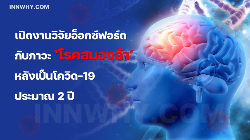 สมองชช้า-1